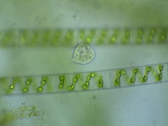 Vorticella