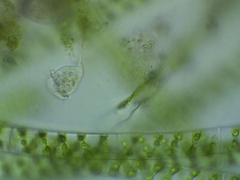 Vorticella