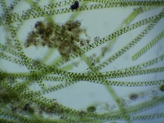 Vorticella