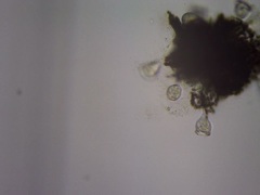 Dolichospermum lemmermannii