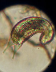 Gastrotricha