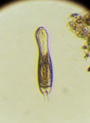 Gastrotricha