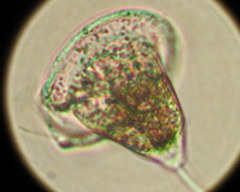 Vorticella