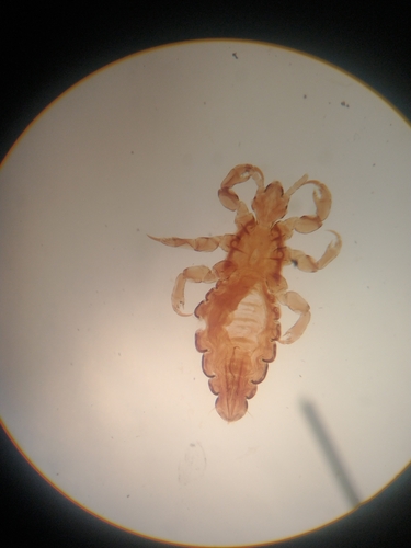 Head louse