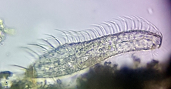 Gastrotricha