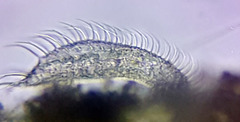 Gastrotricha