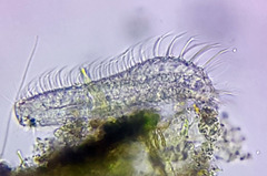 Gastrotricha
