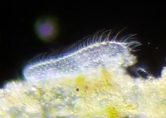 Gastrotricha