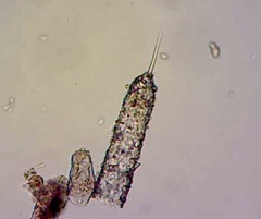 Tintinnopsis