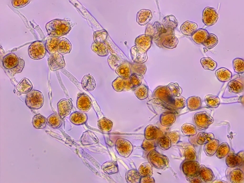 Aecidium ficariae