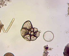 Foraminifera