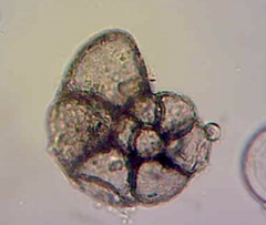 Foraminifera