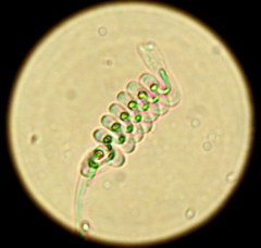 Vorticella