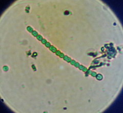 Anabaena
