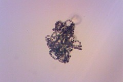 Dolichospermum