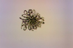 Dolichospermum