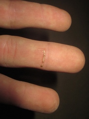 Rena humilis humilis