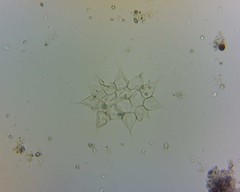 Hydrodictyaceae