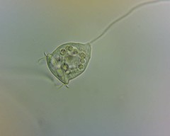 Vorticella
