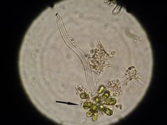Ophiocytium arbuscula