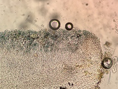 Bacidia circumspecta