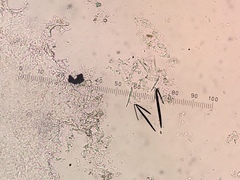 Bacidia circumspecta