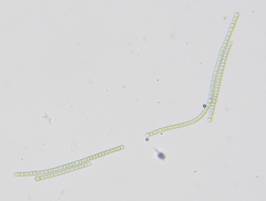 Anabaena