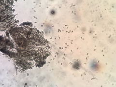 Chaenothecopsis pusilla