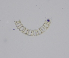 Eucampia zodiacus