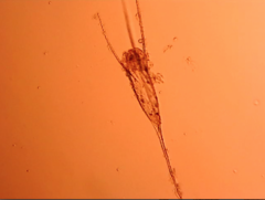 Kellicottia longispina