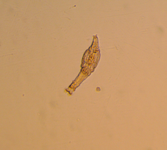 Bdelloidea
