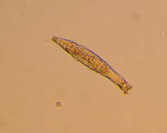 Bdelloidea