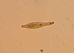 Bdelloidea