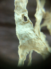 Ramalina subleptocarpha