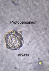 Protoperidinium