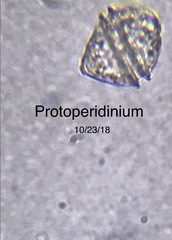 Protoperidinium