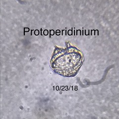 Protoperidinium