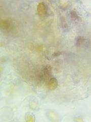 Cortinarius anthracinus