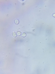 Cuphophyllus canescens