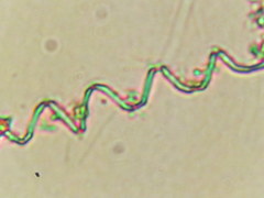 Vorticella
