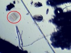 Fragilaria