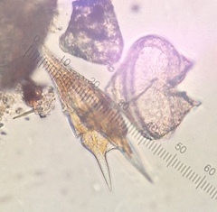 Protoperidinium