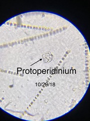 Protoperidinium