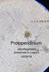 Protoperidinium