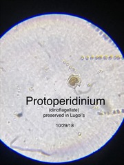 Protoperidinium
