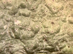 Pertusaria ostiolata