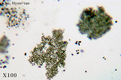 Microcystis
