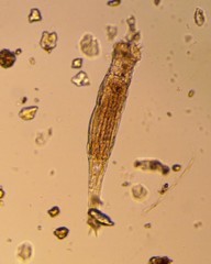 Bdelloidea