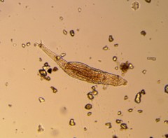 Bdelloidea