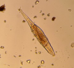 Bdelloidea